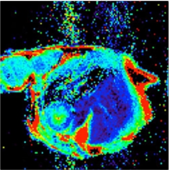 mri 2.jpg